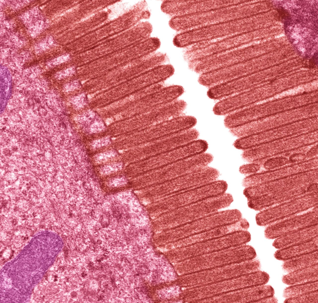 Colourised electron micrograph of intestinal villi and their brush border of microvilli